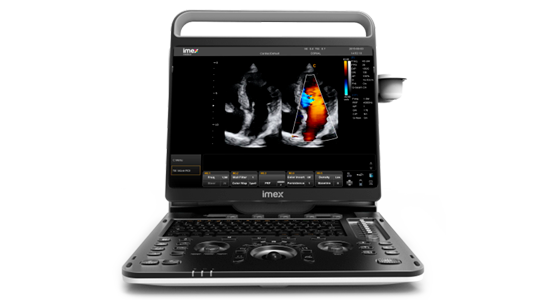 Nova Linha de Ultrassons Imex Medical: um portfólio completo para transformar diagnósticos