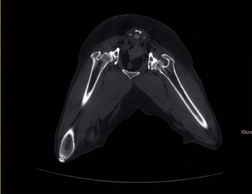 Imagine One Vet - New Edition