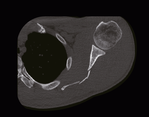 Imagine One - UP
